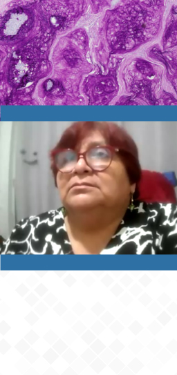 MDN